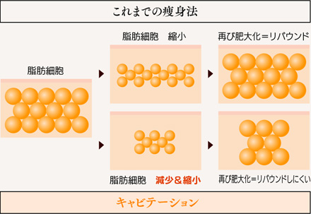 キャビテーションは脂肪細胞を減少、縮小させリバウンドしにくい身体をつくります。